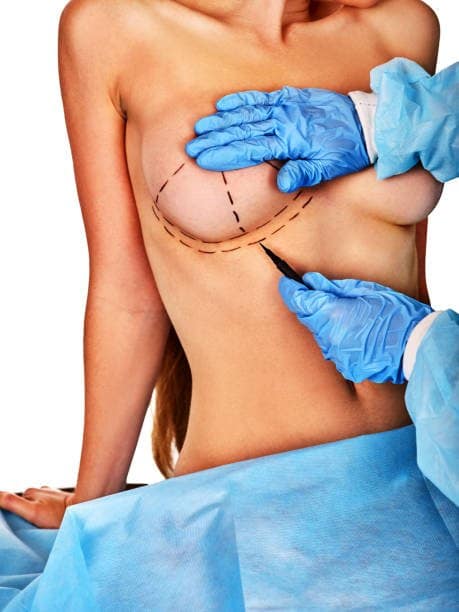 Mamoplastia portada